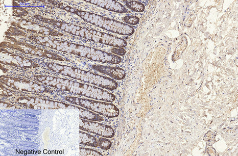 Cytokeratin 8 (10A5) Mouse Monoclonal Antibody