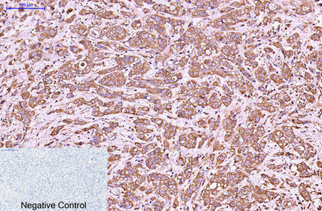 Cytokeratin 6 (1A5) Mouse Monoclonal Antibody