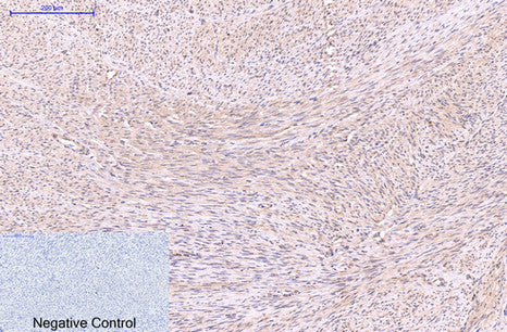 EFHD1 (5C10) Mouse Monoclonal Antibody