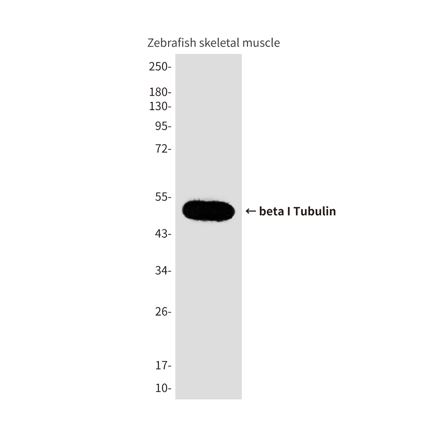 beta I Tubulin (8E6) Mouse Monoclonal Antibody