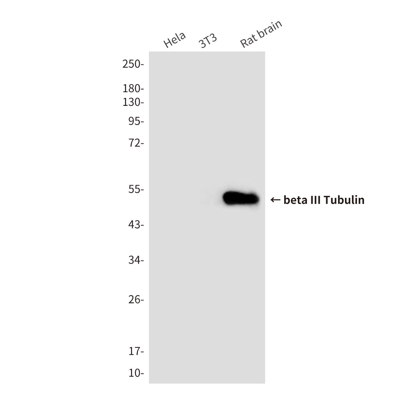beta III Tubulin (3H2) Mouse Monoclonal Antibody