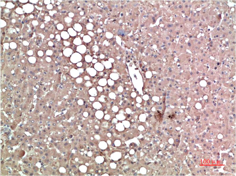 Prealbumin (1F6) Mouse Monoclonal Antibody