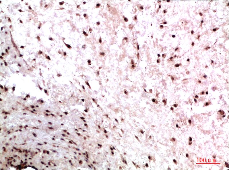 HP1 gamma (9E5) Mouse Monoclonal Antibody