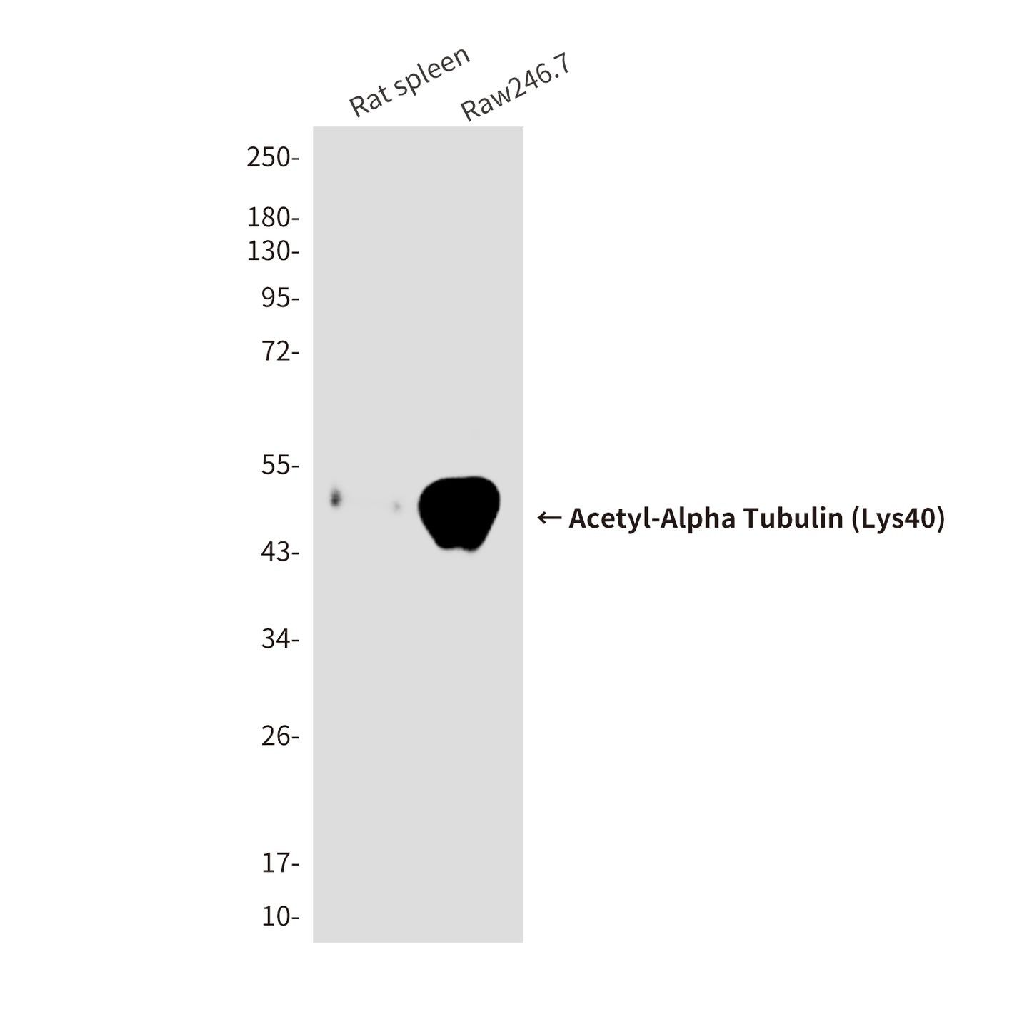 Acetyl-Alpha Tubulin (Lys40) (6B5) Mouse Monoclonal Antibody