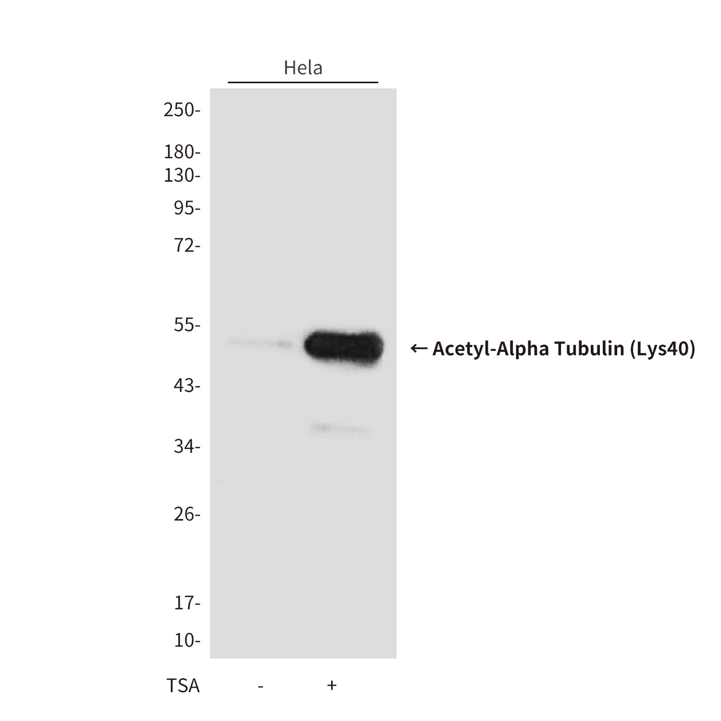 Acetyl-Alpha Tubulin (Lys40) (9B8) Mouse Monoclonal Antibody