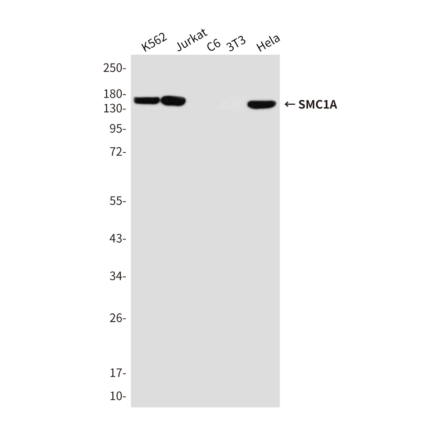 SMC1A Mouse Monoclonal Antibody