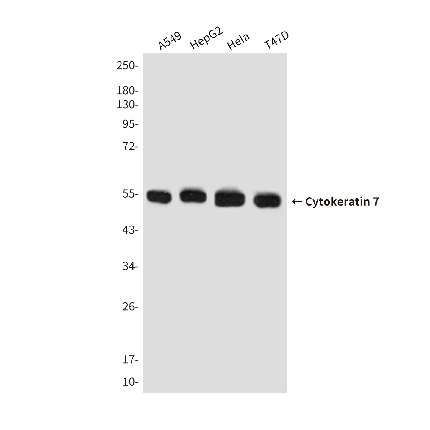Cytokeratin 7 Mouse Monoclonal Antibody