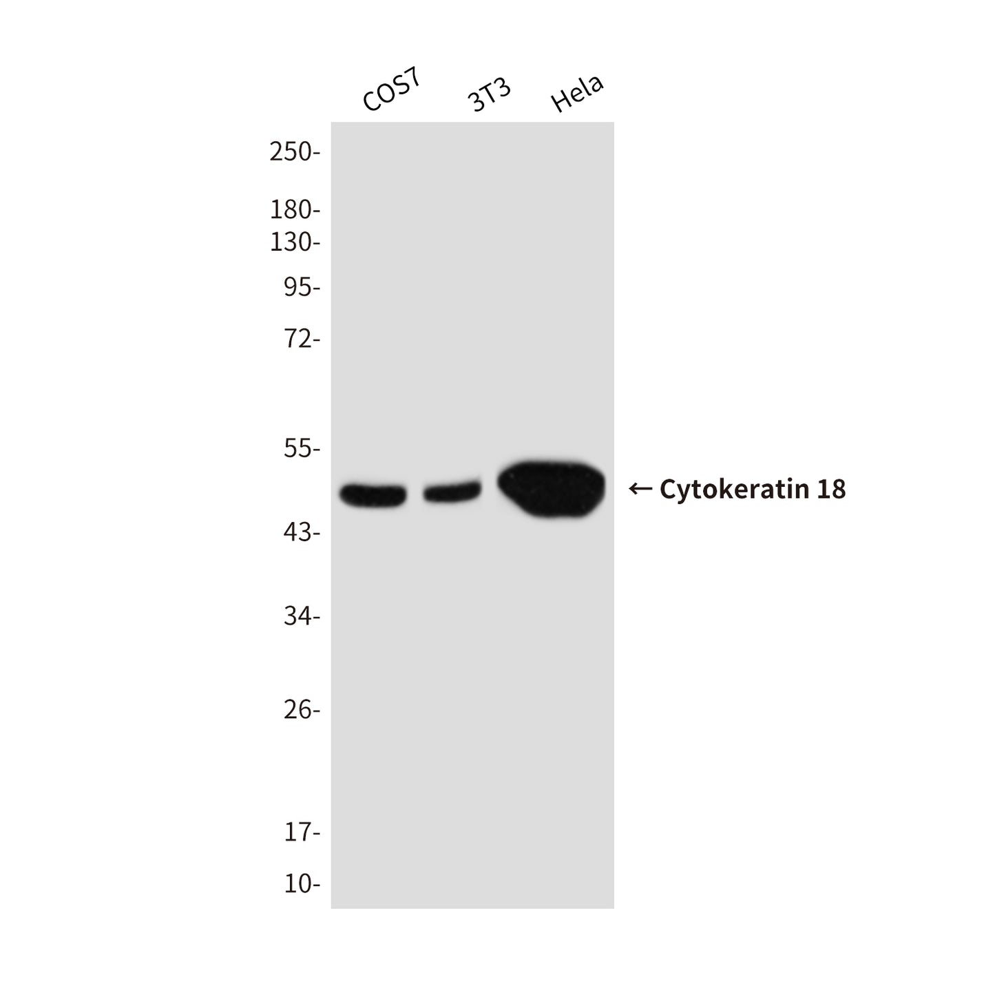 Cytokeratin 18 Mouse Monoclonal Antibody