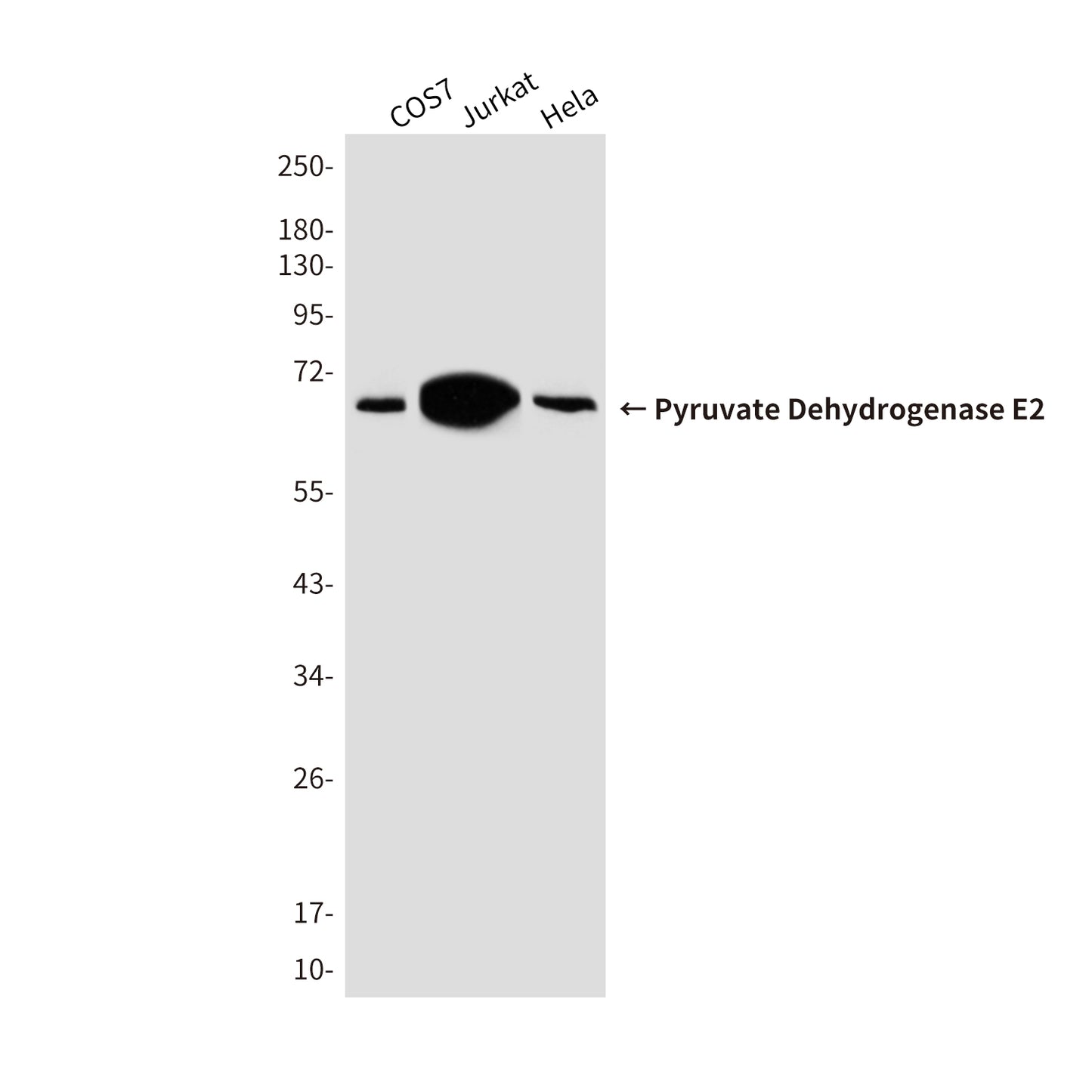 Pyruvate Dehydrogenase E2 Mouse Monoclonal Antibody