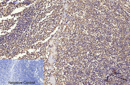 CD68 (9H5) Mouse Monoclonal Antibody