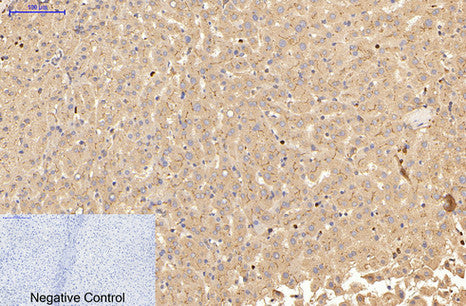 Carcino Embryonic Antigen CEA (2A8) Mouse Monoclonal Antibody