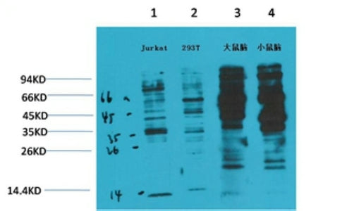 Phospho-Tyrosine (6G6) Mouse Monoclonal Antibody