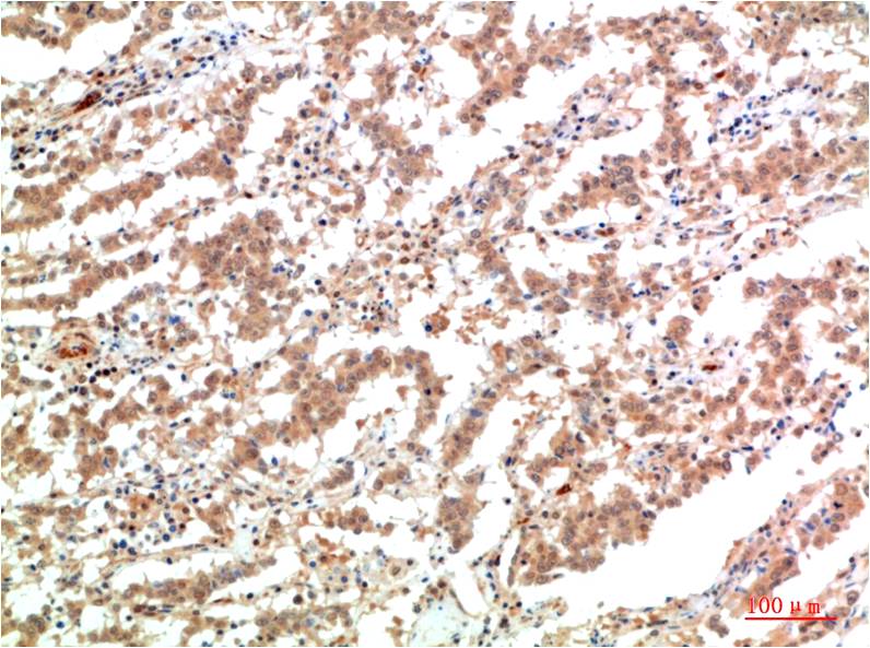 JAK2 (7H5) Mouse Monoclonal Antibody