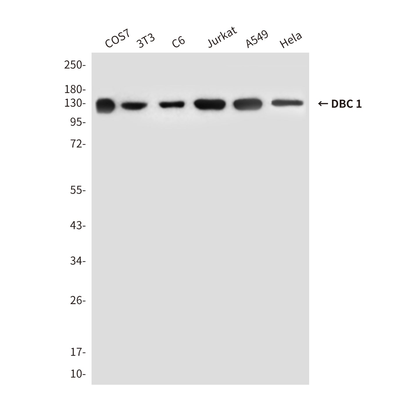 DBC 1 (3G4) Mouse Monoclonal Antibody