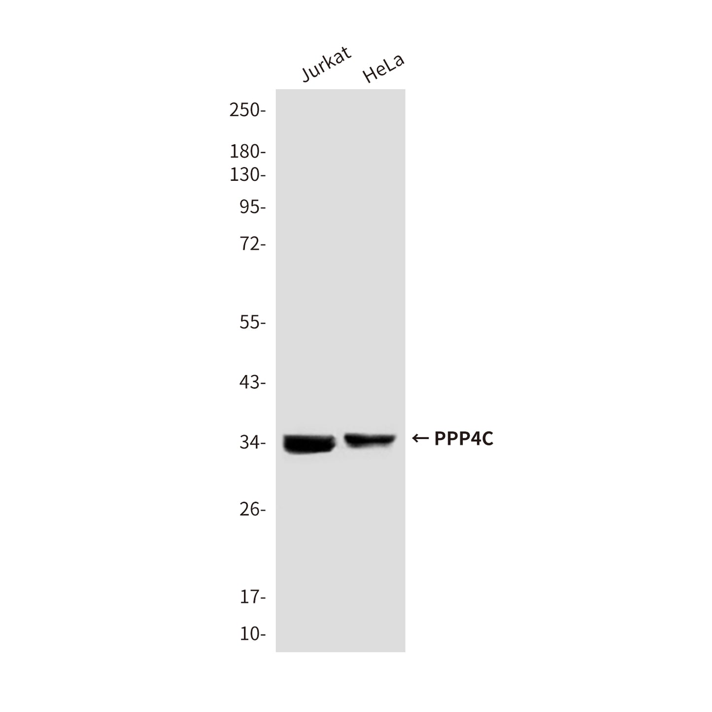PPP4C (2F11) Mouse Monoclonal Antibody