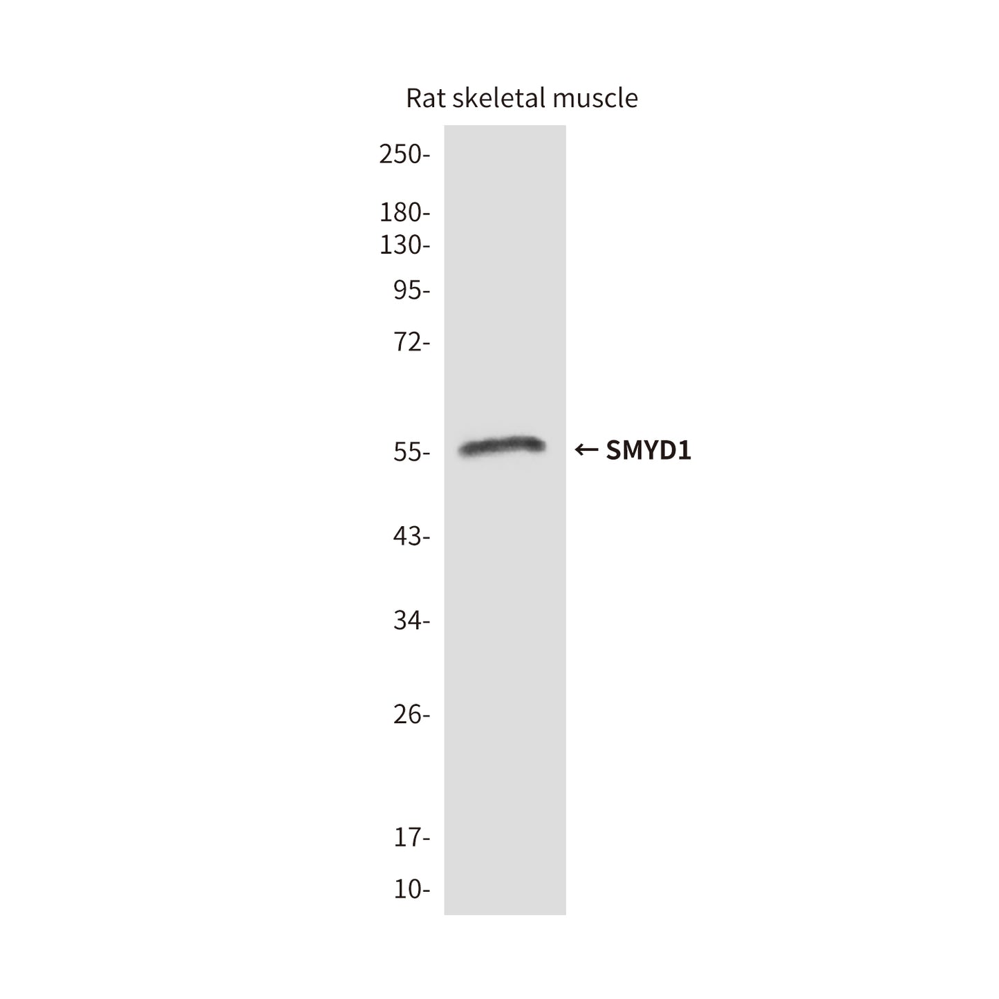 SMYD1 (2E11) Mouse Monoclonal Antibody