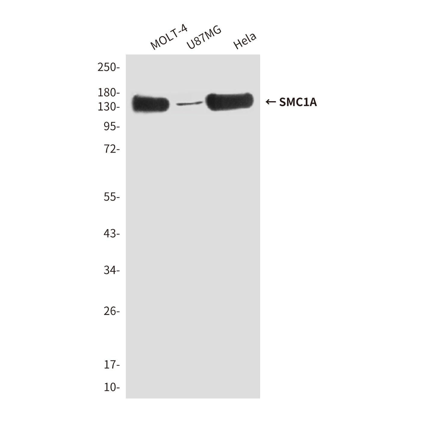 SMC1A (4C5) Mouse Monoclonal Antibody