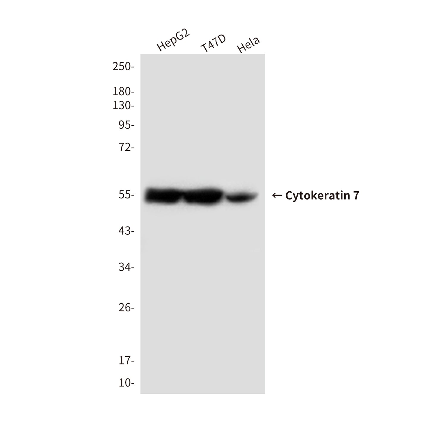 Cytokeratin 7 (4G9) Mouse Monoclonal Antibody