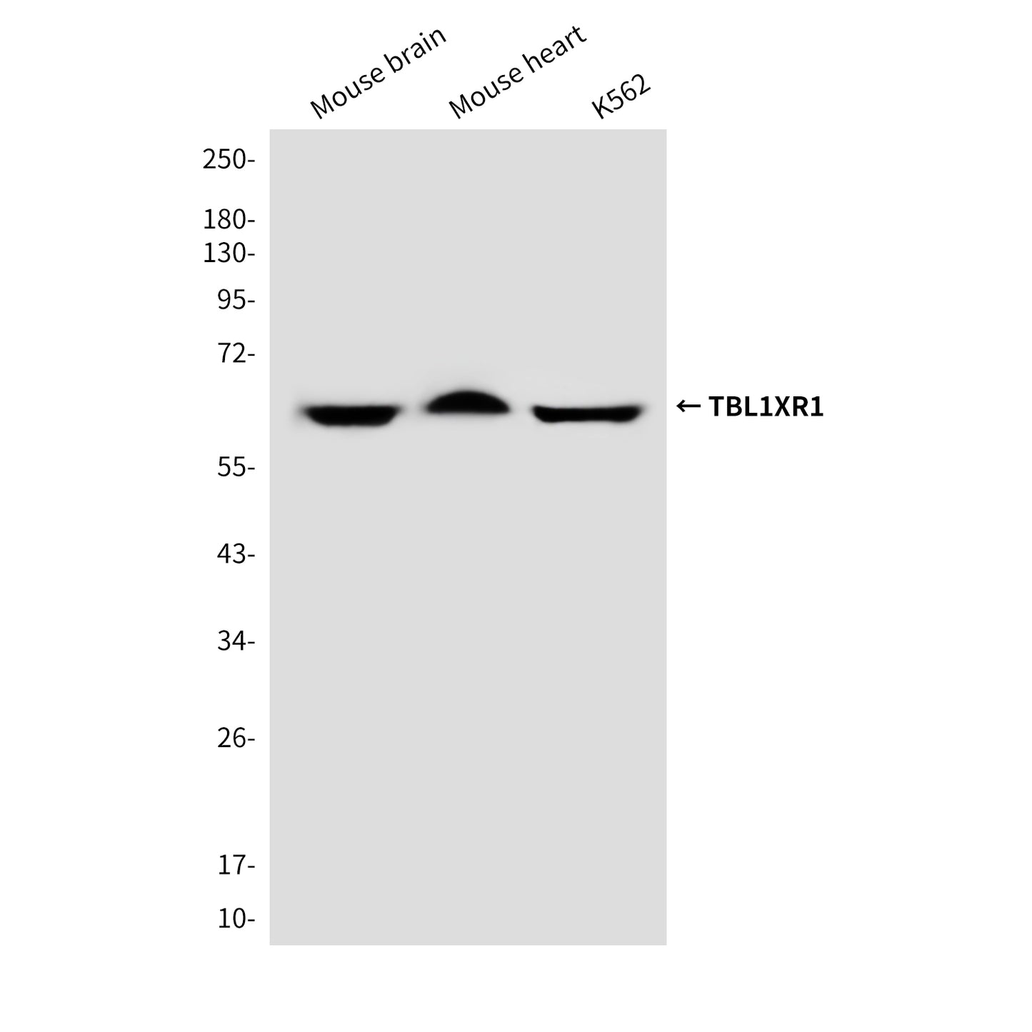 TBL1XR1 (4F3) Mouse Monoclonal Antibody