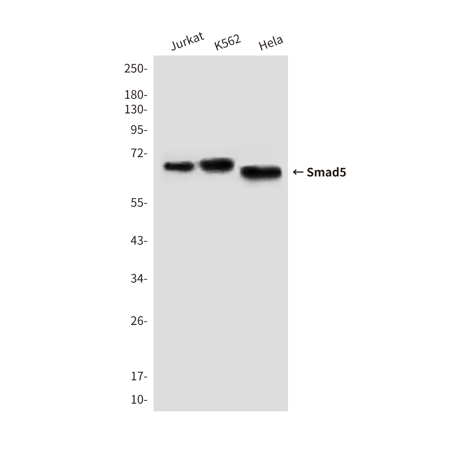 Smad5 (4B10) Mouse Monoclonal Antibody
