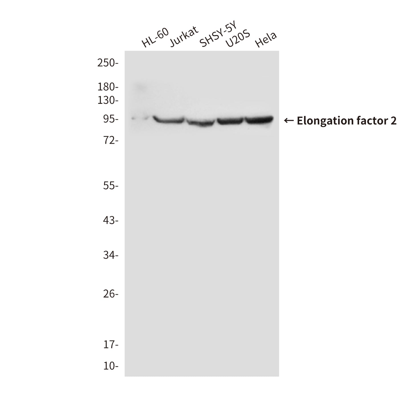 Elongation factor 2 (4B3) Mouse Monoclonal Antibody