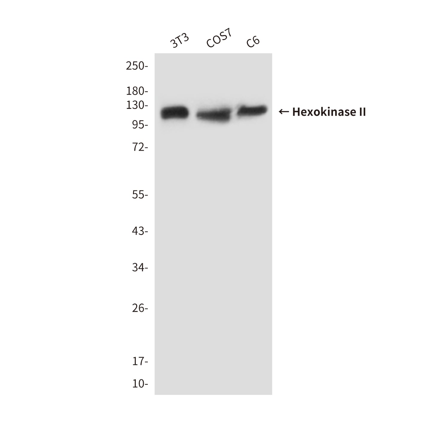 Hexokinase II (1E8) Mouse Monoclonal Antibody