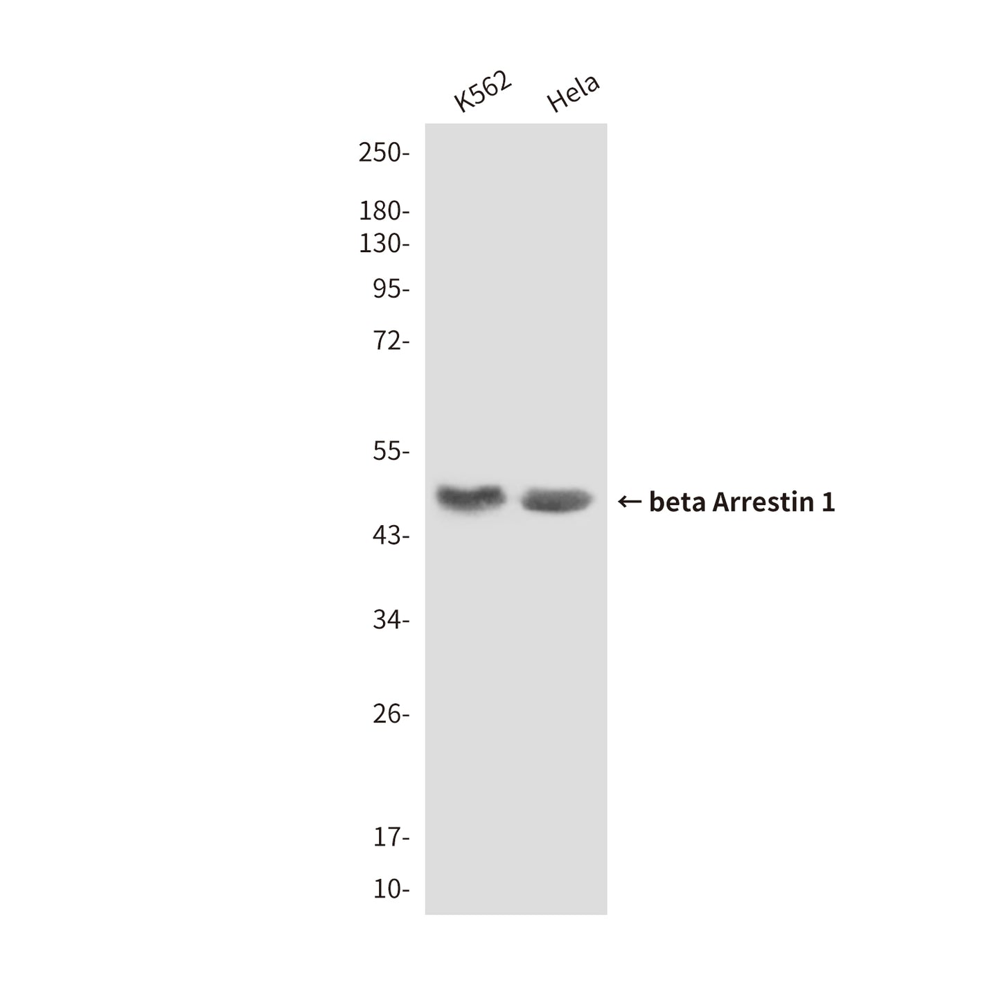 beta Arrestin 1 (6A1) Mouse Monoclonal Antibody