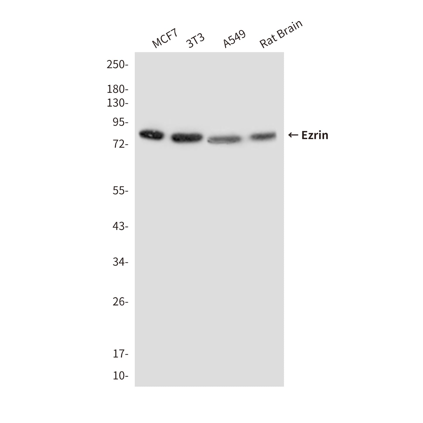 Ezrin (2C12) Mouse Monoclonal Antibody