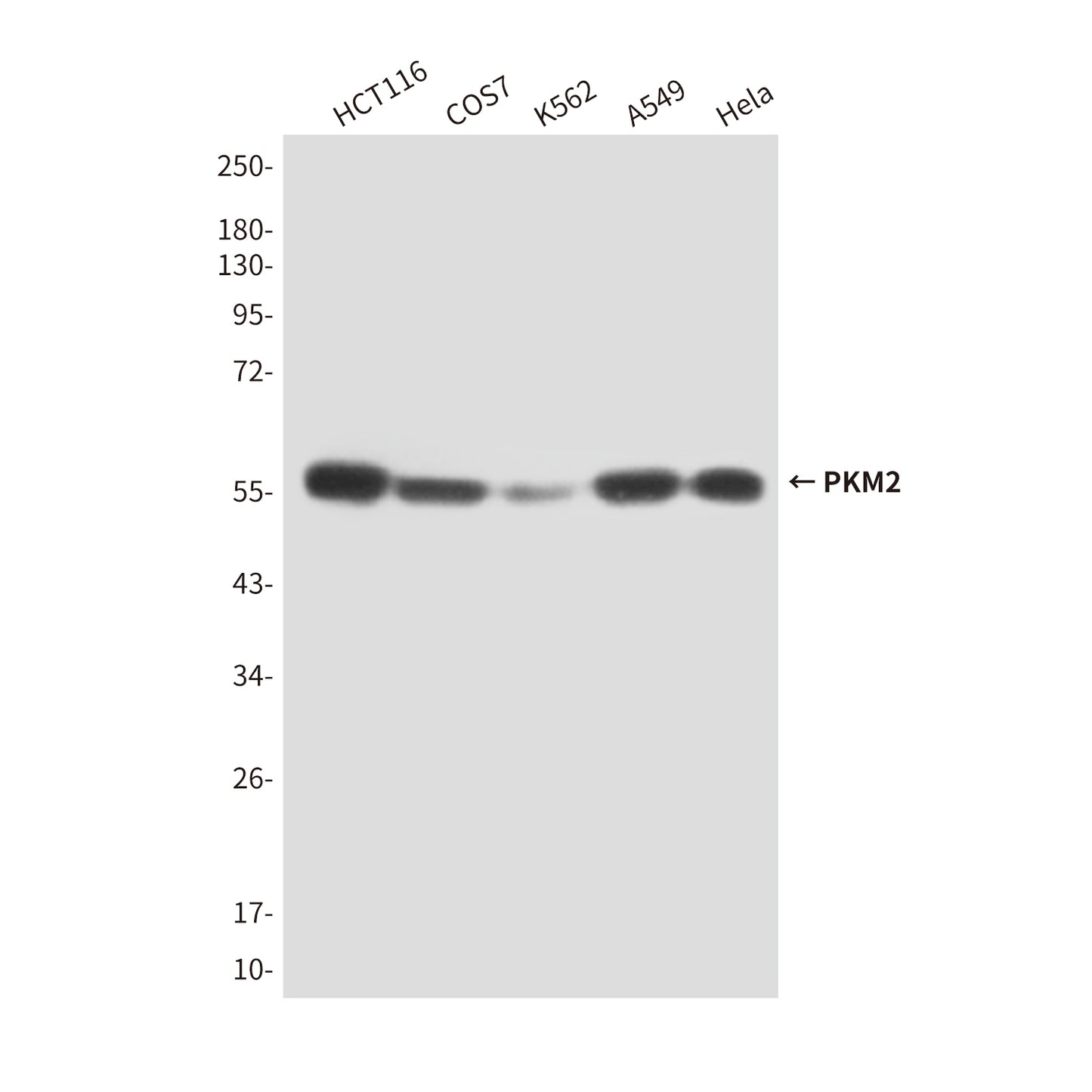 PKM2 (1F2) Mouse Monoclonal Antibody