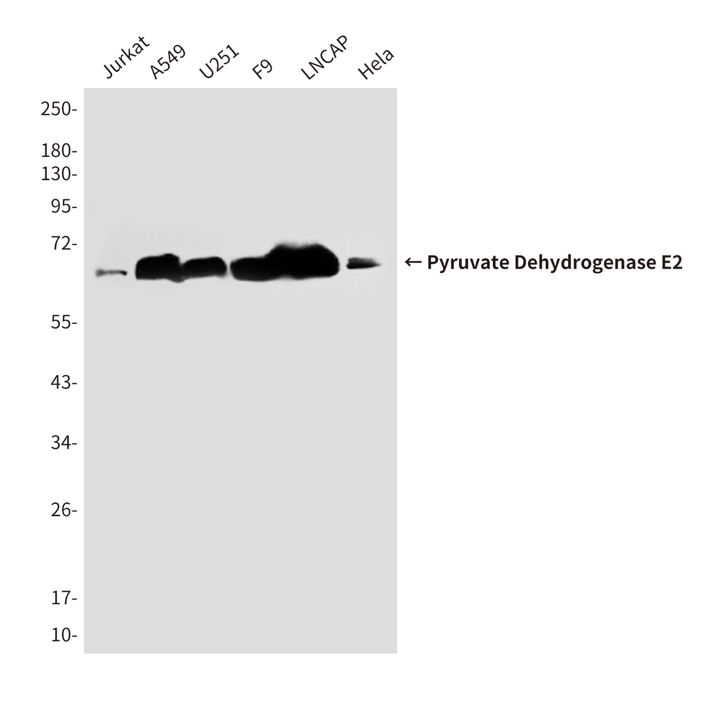 Pyruvate Dehydrogenase E2 (4A4) Mouse Monoclonal Antibody