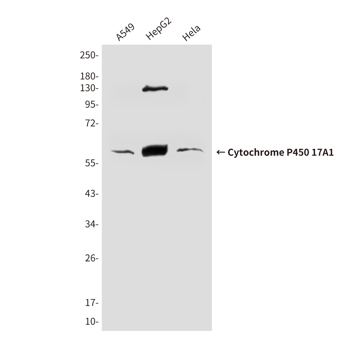 Cytochrome P450 17A1 (6E1) Mouse Monoclonal Antibody