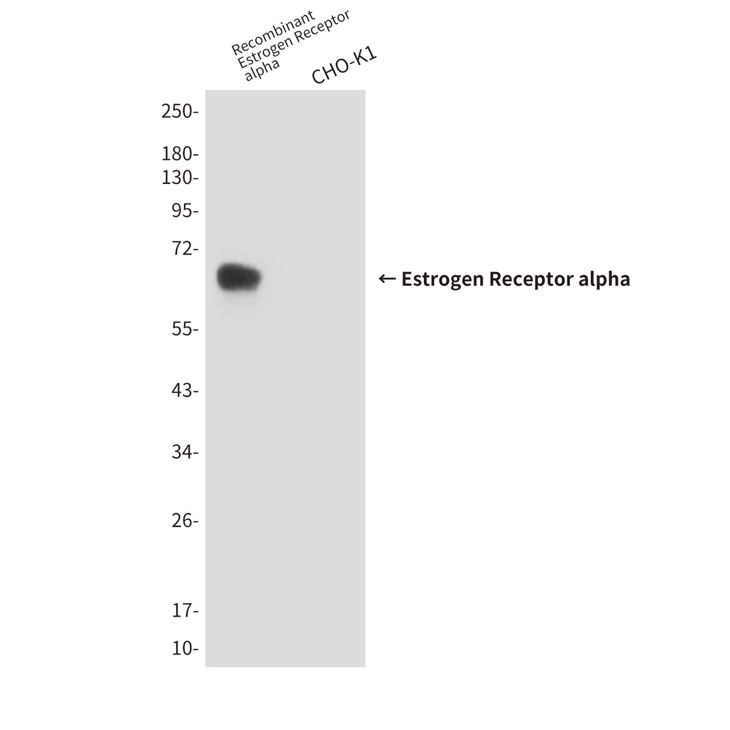 Estrogen Receptor alpha (6F11) Mouse Monoclonal Antibody