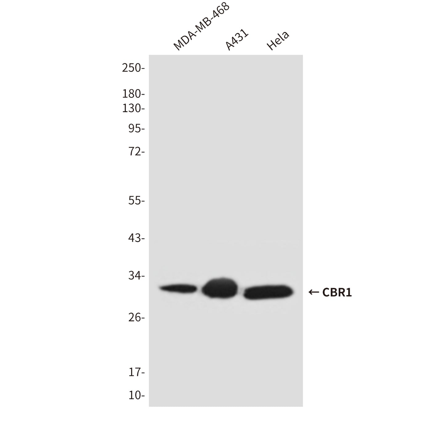 CBR1 (2C9) Mouse Monoclonal Antibody