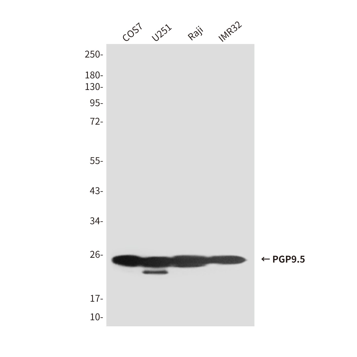PGP9.5 (7B8) Mouse Monoclonal Antibody