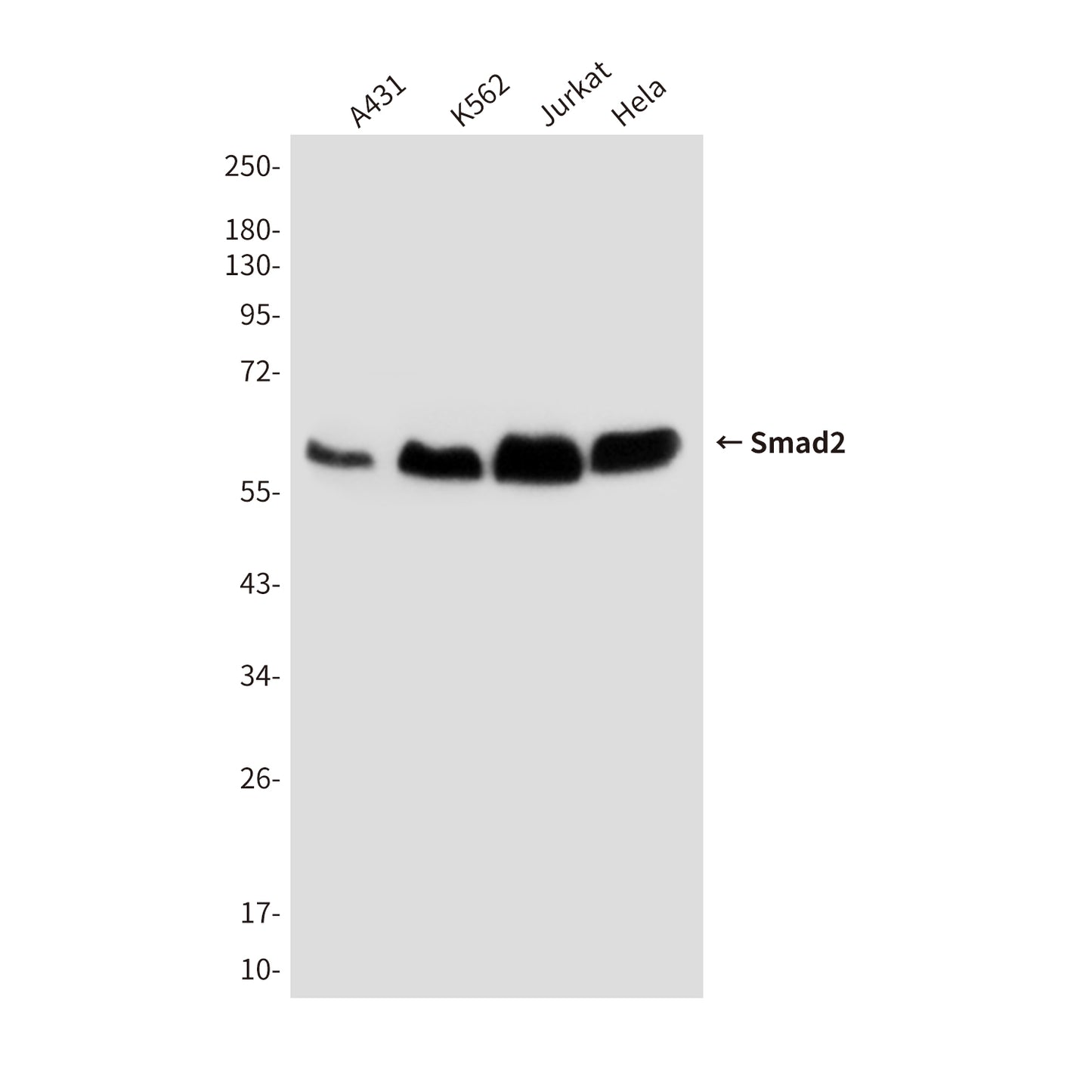 Smad2 (6H5) Mouse Monoclonal Antibody