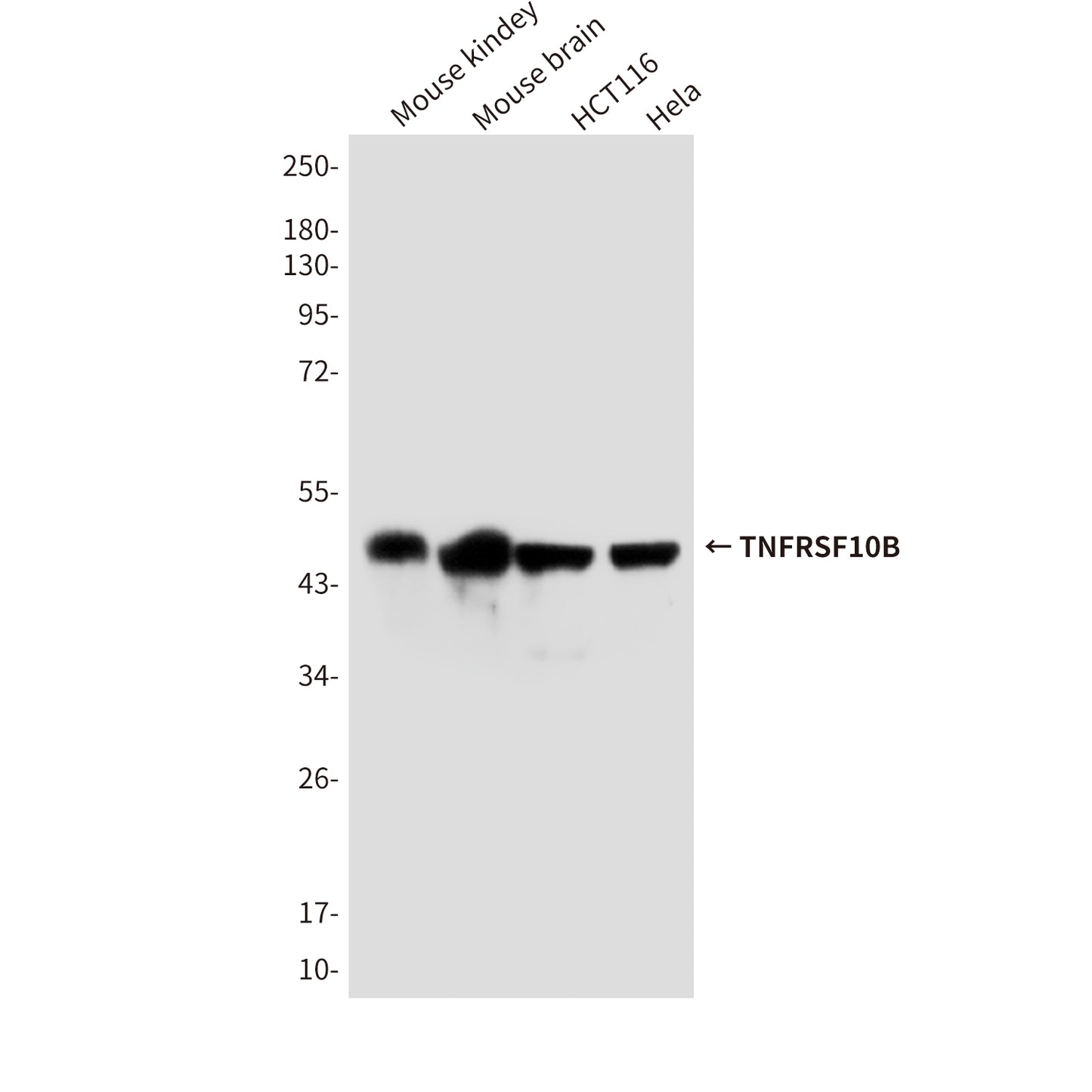 TNFRSF10B (7F4) Mouse Monoclonal Antibody