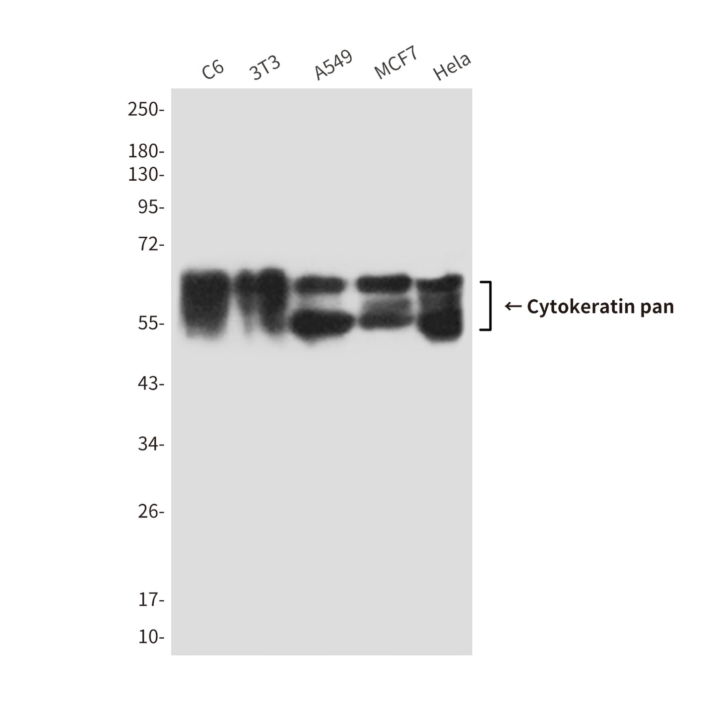 Cytokeratin pan (7H5) Mouse Monoclonal Antibody