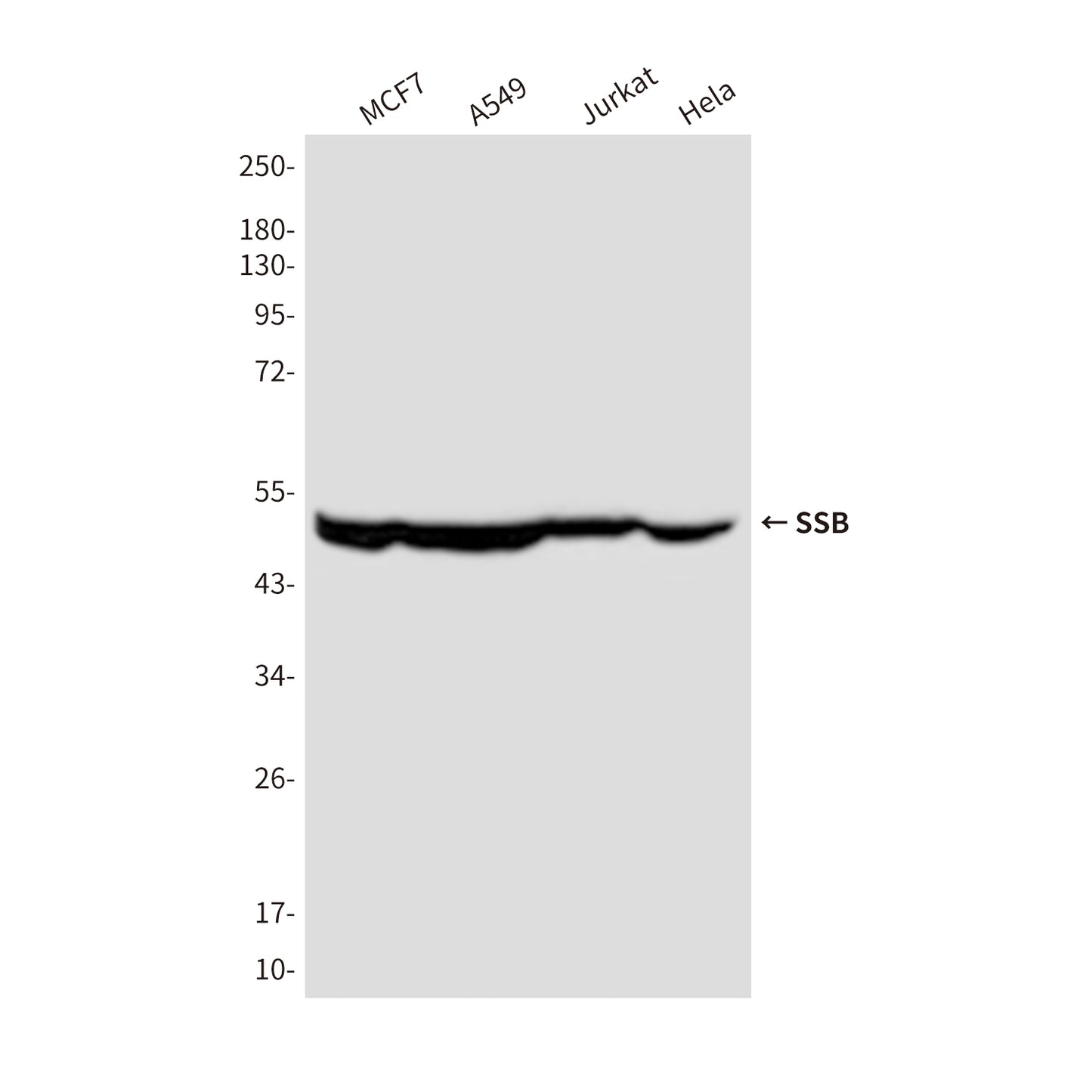 SSB (4B10) Mouse Monoclonal Antibody
