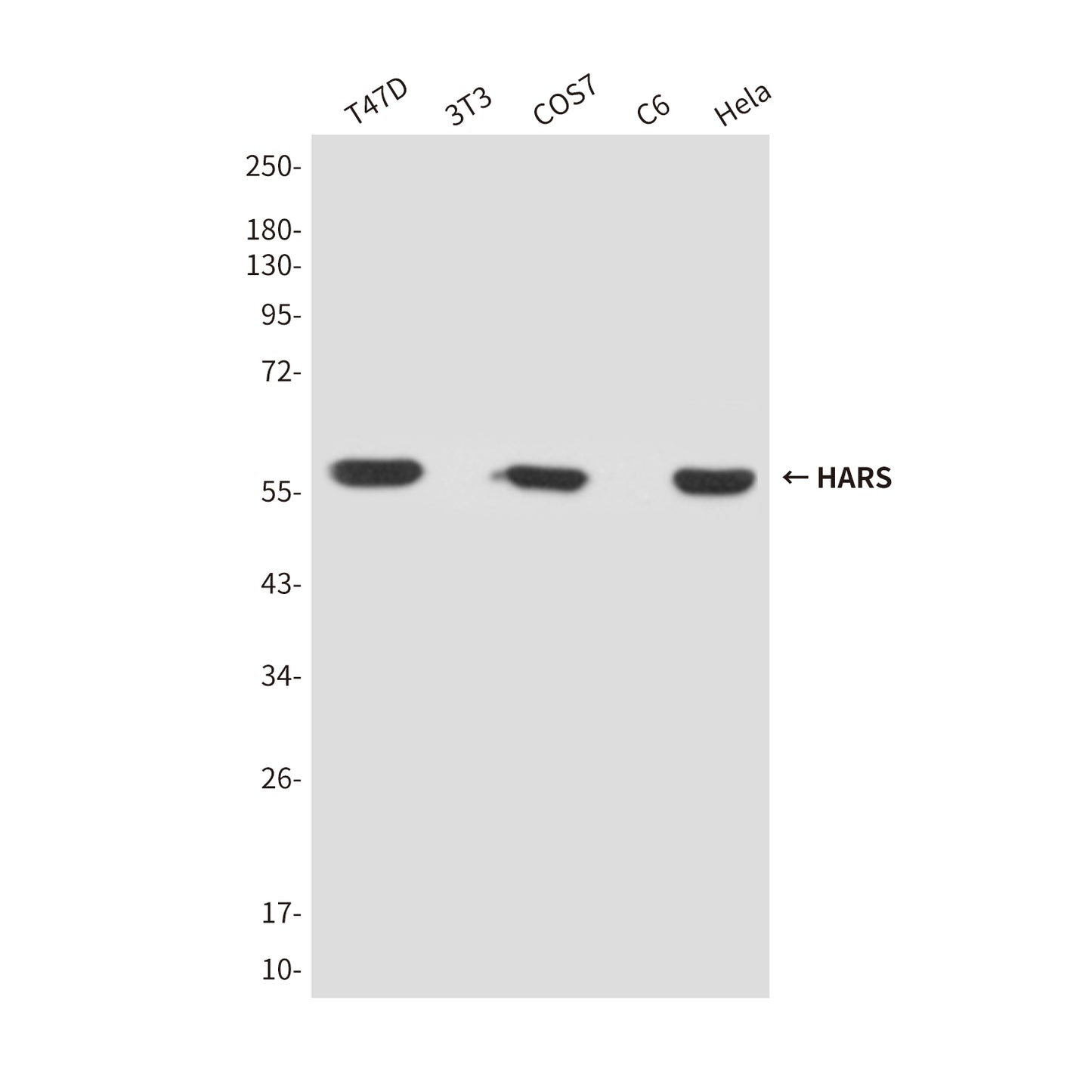 HARS (4H5) Mouse Monoclonal Antibody