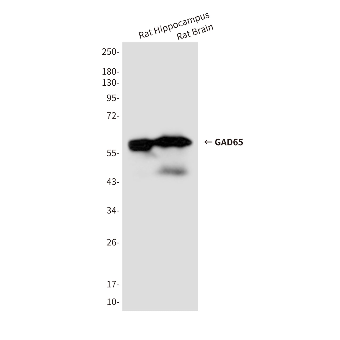 GAD65 (6D5) Mouse Monoclonal Antibody