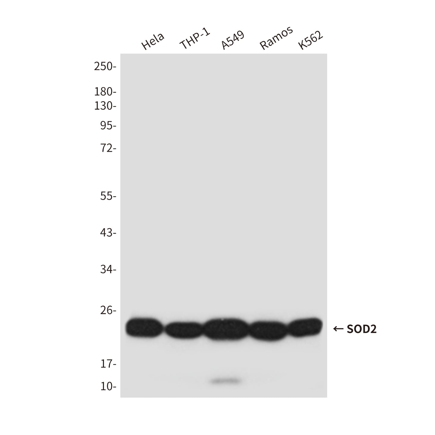 SOD2 (4C4) Mouse Monoclonal Antibody