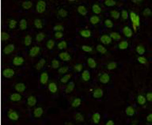 MLH1 (4C1) Mouse Monoclonal Antibody