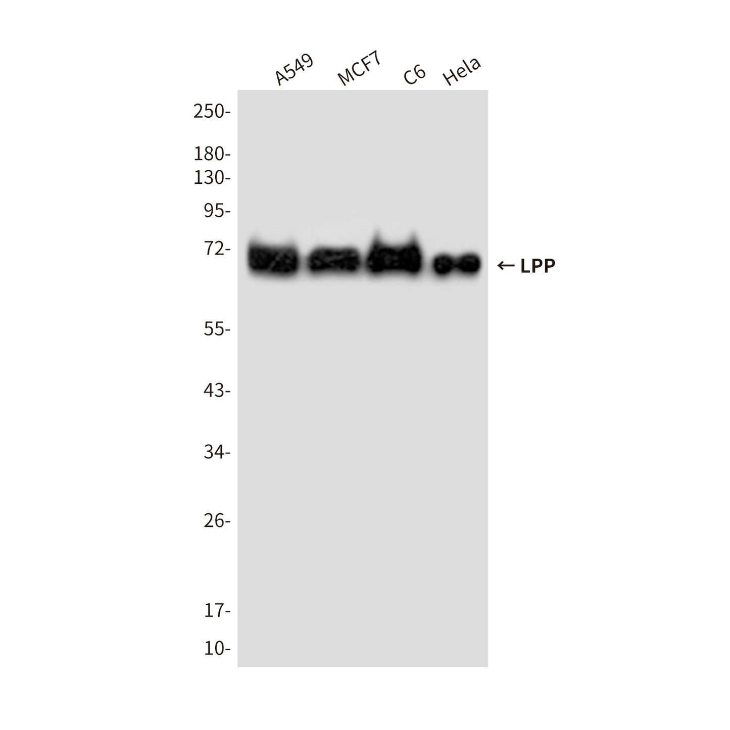 LPP (6F6) Mouse Monoclonal Antibody