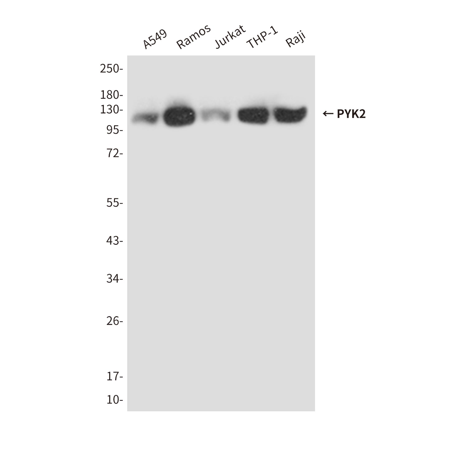 PYK2 (4B4) Mouse Monoclonal Antibody