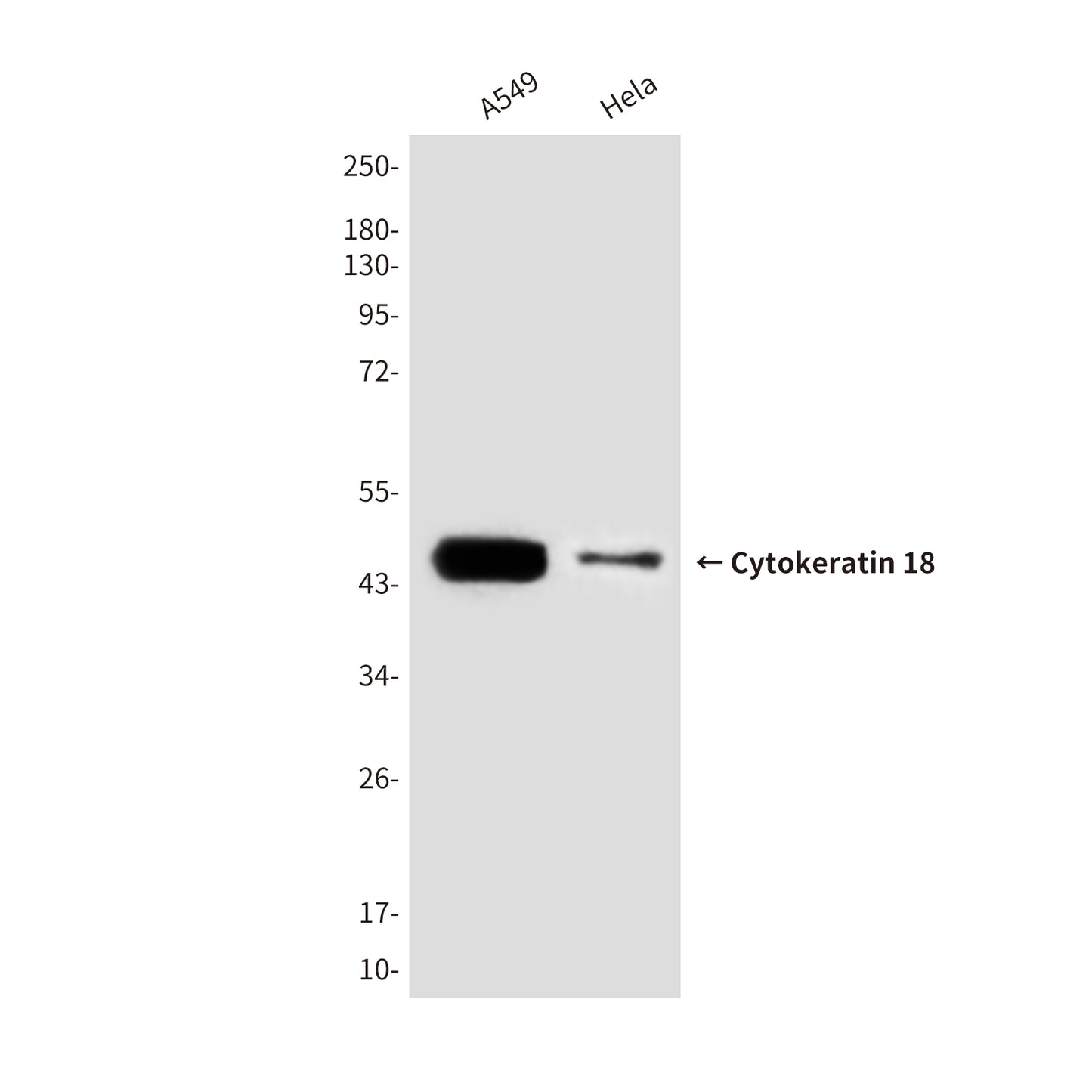 Cytokeratin 18 (6A8) Mouse Monoclonal Antibody