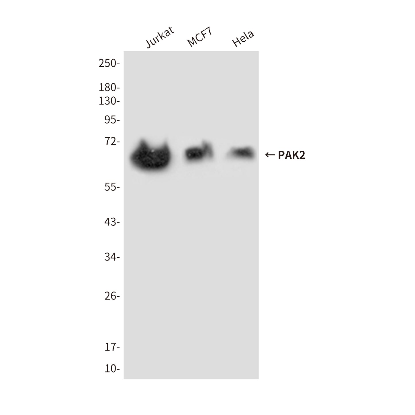 PAK2 (7H3) Mouse Monoclonal Antibody
