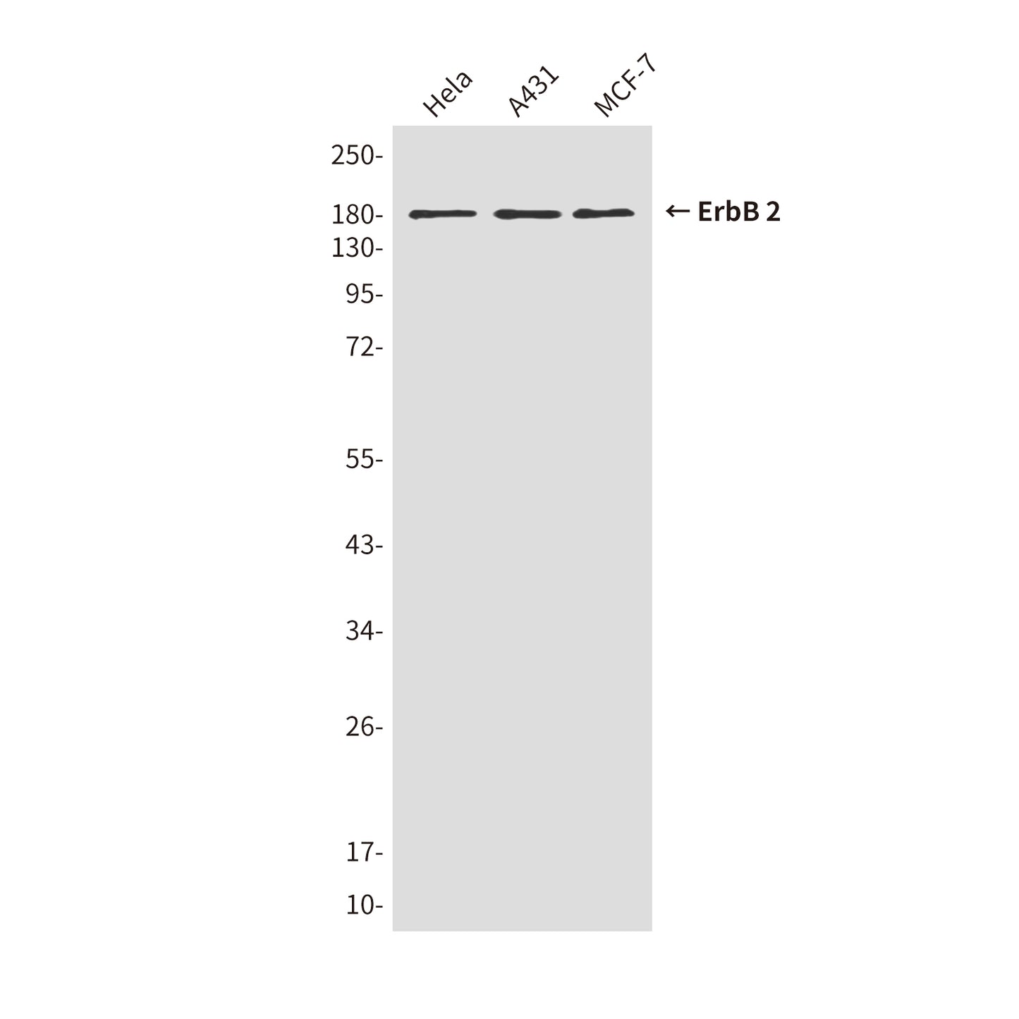 ErbB 2 (1C4) Mouse Monoclonal Antibody