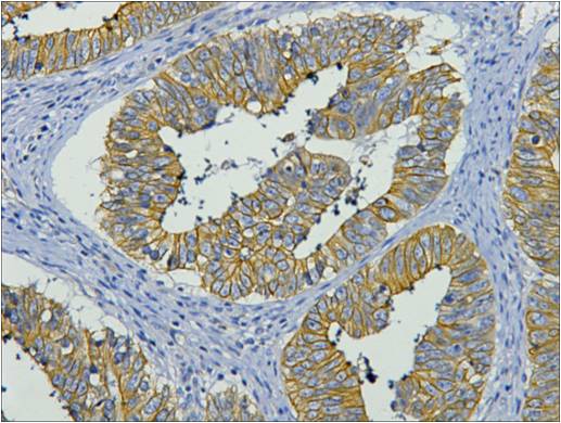 Cytokeratin 19 (10G10) Mouse Monoclonal Antibody