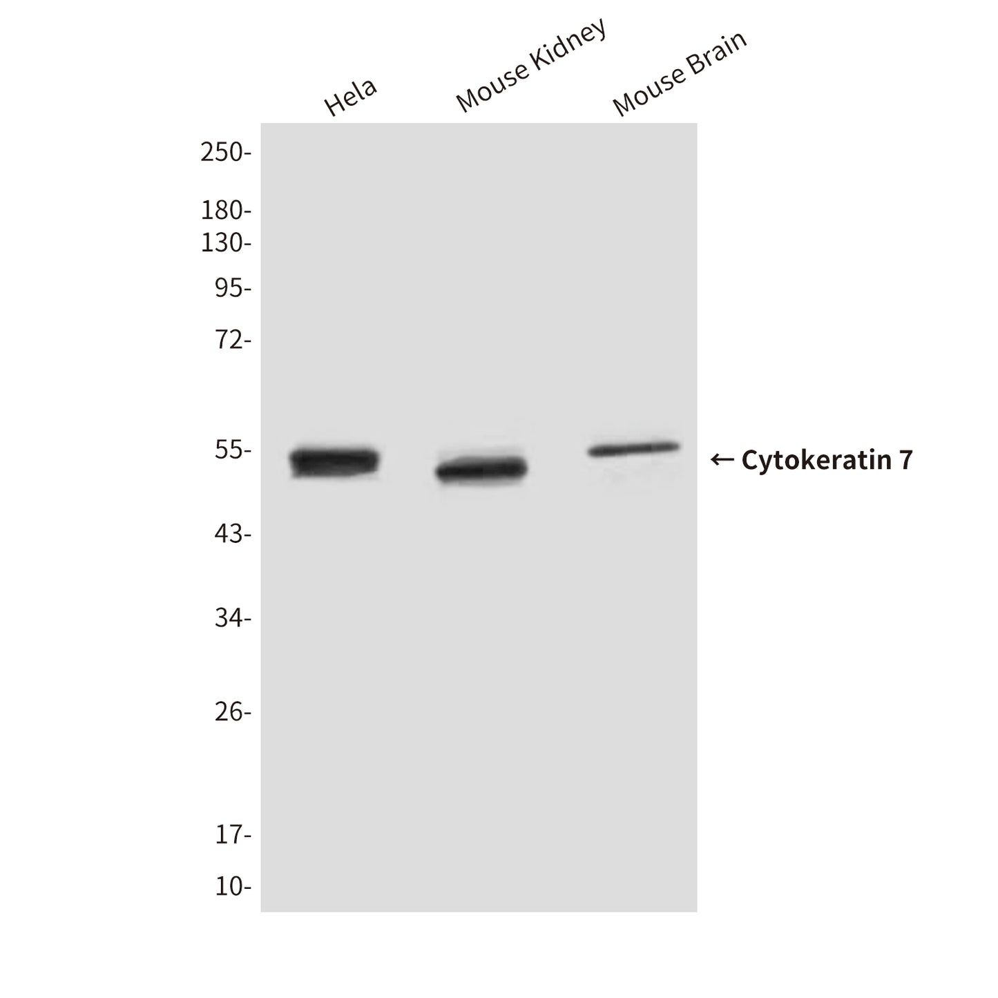 Cytokeratin 7 (9G9) Mouse Monoclonal Antibody