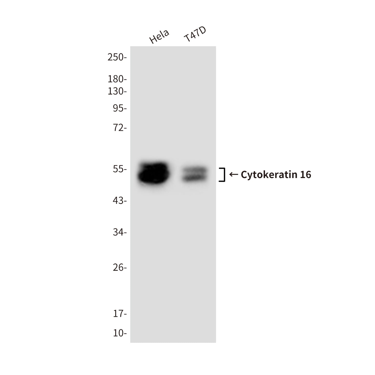 Cytokeratin 16 (10C7) Mouse Monoclonal Antibody